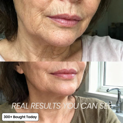 PDRN KOREAN SKINCARE Collagen Plump & Repair Balm