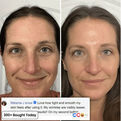 PDRN KOREAN SKINCARE Collagen Plump & Repair Balm